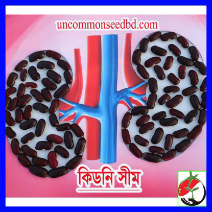 Picture of BNK509. কিডনি সীম #কুরিয়ার ফ্রি[Min Order 4(This Item Or Any)] ১০০/=অগ্রীম